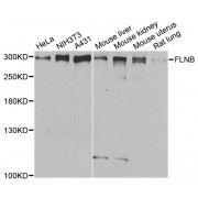 Western blot analysis of extracts of various cell lines, using FLNB antibody (abx001925) at 1/1000 dilution.
