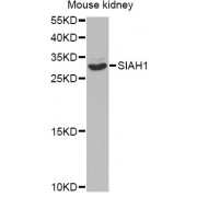 Western blot analysis of extracts of mouse kidney, using SIAH1 antibody (abx001938) at 1/1000 dilution.