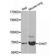 Western blot analysis of extracts of various cell lines, using CHAT antibody (abx001939) at 1/1000 dilution.