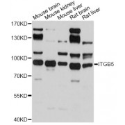 Western blot analysis of extracts of various cell lines, using ITGB5 antibody (abx001941) at 1/500 dilution.