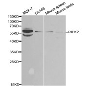 Western blot analysis of extracts of various cell lines, using RIPK2 antibody (abx001942) at 1/1000 dilution.