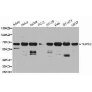 Western blot analysis of extracts of various cell lines, using NUP62 antibody (abx001943) at 1/1000 dilution.