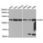 Western blot analysis of extracts of various cell lines, using CASK antibody (abx001945) at 1/1000 dilution.