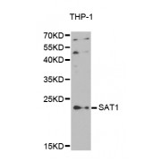 Western blot analysis of extracts of THP-1 cells, using SAT1 antibody (abx001949).