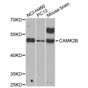 Western blot analysis of extracts of various cell lines, using CAMK2B antibody (abx001950) at 1/1000 dilution.