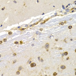 Eukaryotic Translation Elongation Factor 1 Delta (EEF1D) Antibody