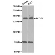 Western blot analysis of extracts of various cell lines, using TCOF1 antibody (abx001954) at 1/1000 dilution.