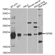 Western blot analysis of extracts of various cell lines, using HSPB8 antibody (abx001956) at 1/1000 dilution.