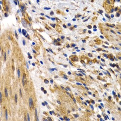 Heat Shock Protein Beta 8 (HSPB8) Antibody