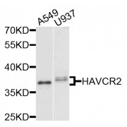 Western blot analysis of extracts of various cell lines, using HAVCR2 antibody (abx001957) at 1/1000 dilution.