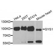 Western blot analysis of extracts of various cell lines, using GYS1 antibody (abx001960) at 1/1000 dilution.