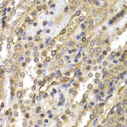 Neural Precursor Cell Expressed, Developmentally Down-Regulated 9 (NEDD9) Antibody