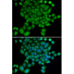 Neural Precursor Cell Expressed, Developmentally Down-Regulated 9 (NEDD9) Antibody