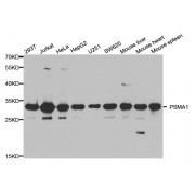 Western blot analysis of extracts of various cell lines, using PSMA1 antibody (abx001963) at 1/1000 dilution.