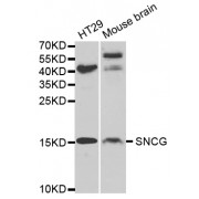 Western blot analysis of extracts of various cell lines, using SNCG antibody (abx001964) at 1/1000 dilution.