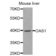 Western blot analysis of extracts of mouse liver, using OAS1 antibody (abx001970) at 1/1000 dilution.