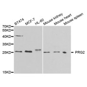 Western blot analysis of extracts of various cell lines, using PRG2 antibody (abx001972) at 1/1000 dilution.