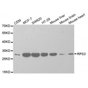 Western blot analysis of extracts of various cell lines, using RPS3 antibody (abx001973) at 1/1000 dilution.