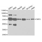 Western blot analysis of extracts of various cell lines, using TMPO antibody (abx001974) at 1/1000 dilution.