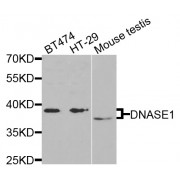 Western blot analysis of extracts of various cell lines, using DNASE1 antibody (abx001975) at 1/1000 dilution.