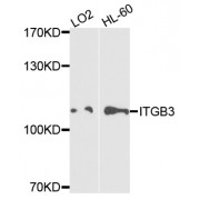 Western blot analysis of extracts of various cell lines, using ITGB3 antibody (abx001980) at 1/1000 dilution.
