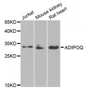 Western blot analysis of extracts of various cell lines, using ADIPOQ antibody (abx001981) at 1/1000 dilution.