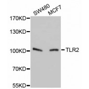 Western blot analysis of extracts of various cell lines, using TLR2 antibody (abx001983) at 1/1000 dilution.