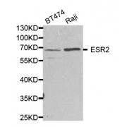 Western blot analysis of extracts of various cell lines, using ESR2 antibody (abx001984) at 1/1000 dilution.