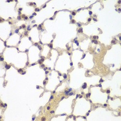 Estrogen Receptor Beta (ESR2) Antibody