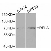 Western blot analysis of extracts of various cell lines, using RELA antibody (abx001985) at 1/1000 dilution.