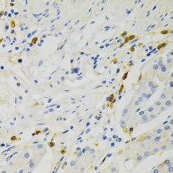 V-Rel Reticuloendotheliosis Viral Oncogene Homolog A (RELA) Antibody