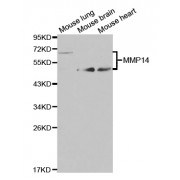 Western blot analysis of extracts of various cell lines, using MMP14 antibody (abx001987) at 1/1000 dilution.