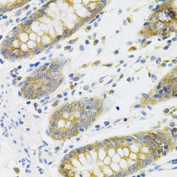Tumor Necrosis Factor Ligand Superfamily Member 11 / RANKL (TNFSF11) Antibody