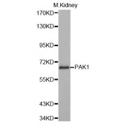 Western blot analysis of extracts of mouse kidney, using PAK1 antibody (abx001991) at 1/1000 dilution.