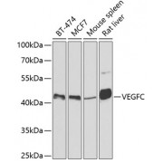 Western blot analysis of extracts of various cell lines, using VEGFC antibody (abx001993) at 1/500 dilution.