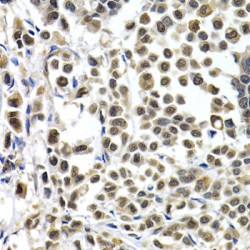 Interferon Regulatory Factor 2 (IRF2) Antibody