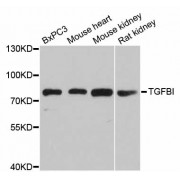 Western blot analysis of extracts of various cell lines, using TGFBI antibody (abx001998) at 1/1000 dilution.