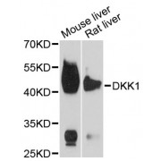 Western blot analysis of extracts of various cell lines, using DKK1 antibody (abx001999) at 1/1000 dilution.