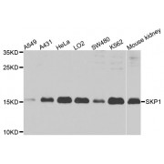 Western blot analysis of extracts of various cell lines, using SKP1 antibody (abx002003) at 1/1000 dilution.