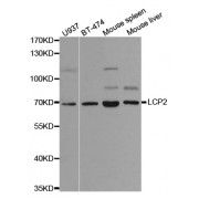 Western blot analysis of extracts of various cell lines, using LCP2 antibody (abx002004) at 1/1000 dilution.