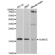 Western blot analysis of extracts of various cell lines, using SUMO2 antibody (abx002008) at 1/1000 dilution.
