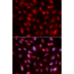 Small Ubiquitin Related Modifier Protein 2 (SUMO2) Antibody