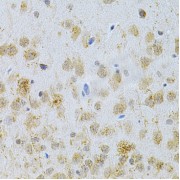 Immunohistochemistry of paraffin-embedded rat brain using MAP2 Antibody (abx002009) at dilution of 1/200 (40x lens).
