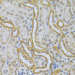 Microtubule Associated Protein 2 (MAP2) Antibody