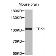 Western blot analysis of extracts of mouse brain, using TBK1 antibody (abx002010) at 1/1000 dilution.