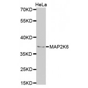 Western blot analysis of extracts of HeLa cells, using MAP2K6 antibody (abx002012) at 1/1000 dilution.