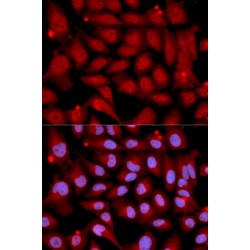 Dual Specificity Mitogen-Activated Protein Kinase Kinase 6 (MAP2K6) Antibody