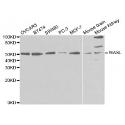 Western blot analysis of extracts of various cell lines, using WASL antibody (abx002013) at 1/1000 dilution.