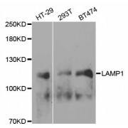 Western blot analysis of extracts of various cell lines, using LAMP1 antibody (abx002018) at 1/1000 dilution.