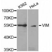 Western blot analysis of extracts of various cell lines, using VIM antibody (abx002020) at 1/1000 dilution.